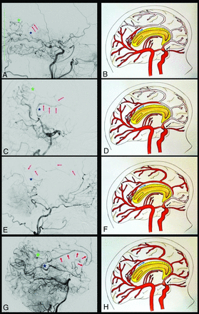 Fig 3.