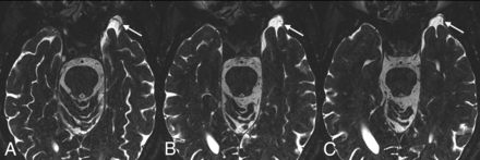 Fig 1.