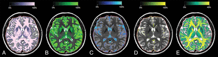 Fig 1.