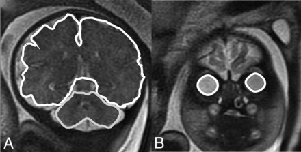 Fig 1.