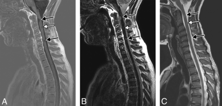 Fig 2.