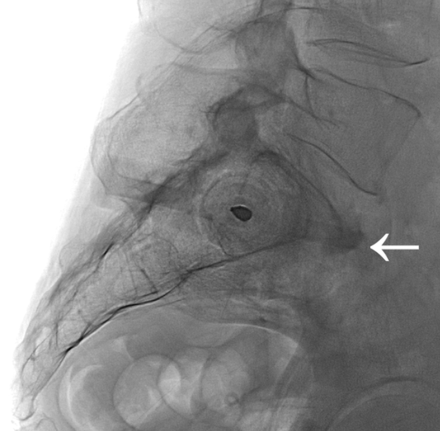 Fig 2.