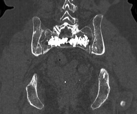 Fig 5.