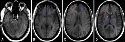Fig 1.