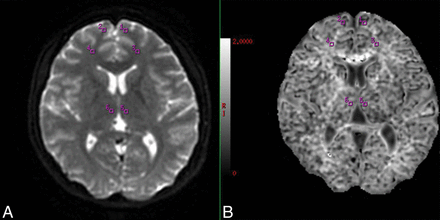 Fig 1.