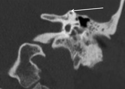 Fig 1.