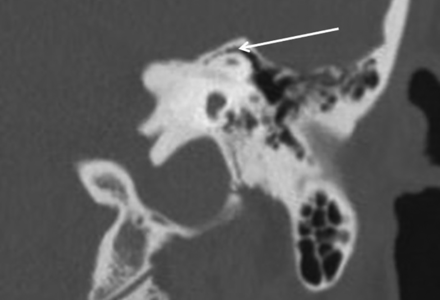 Fig 2.