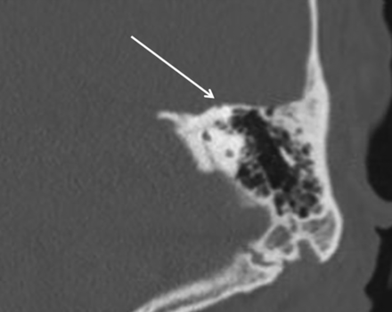 Fig 3.
