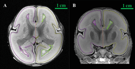 Fig 1.