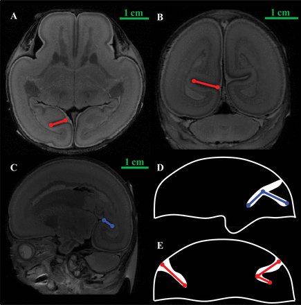 Fig 3.