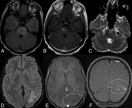 Fig 1.