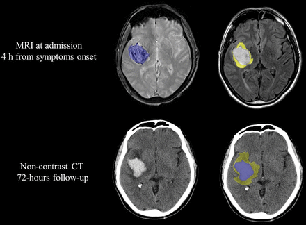 Fig 2.