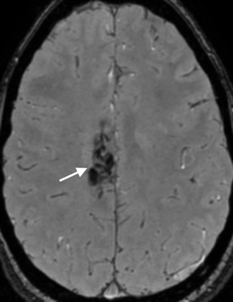 Fig 3.