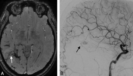 Fig 4.