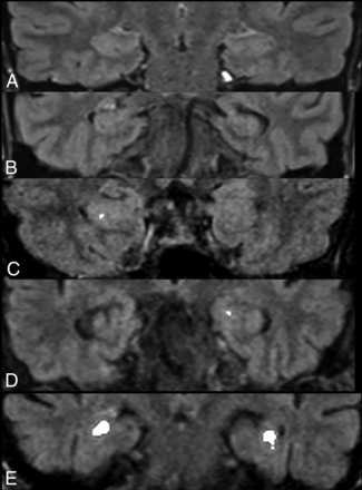 Fig 2.