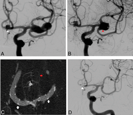 Fig 3.