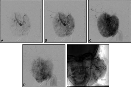 Fig 4.
