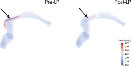Fig 3.