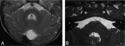 Fig 1.