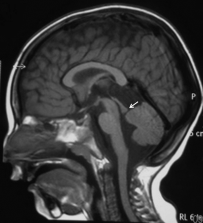 Fig 2.
