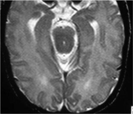 Fig 3.