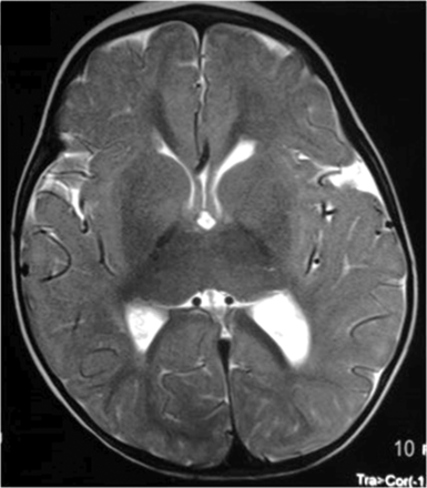 Fig 4.