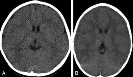 Fig 1.