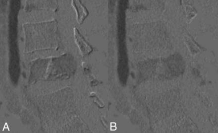Fig 1.