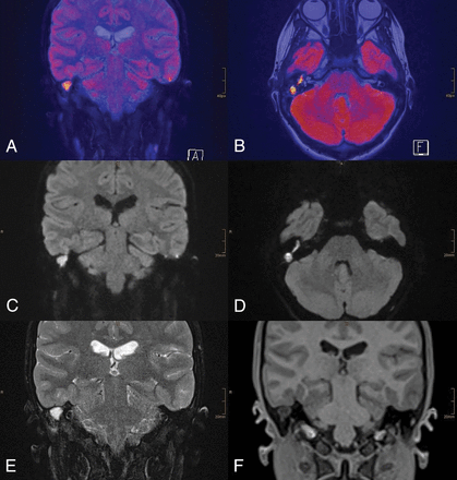 Fig 1.