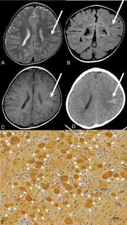 Fig 1.