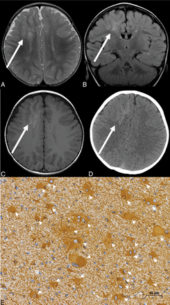 Fig 2.