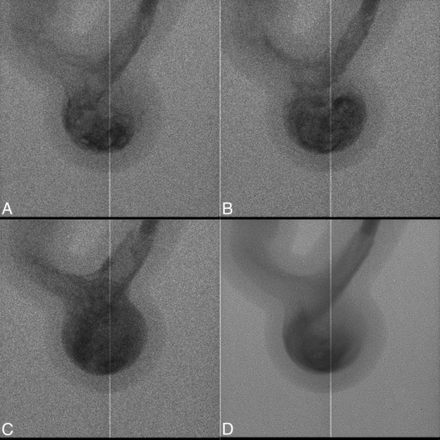 Fig 1.