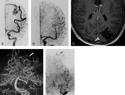 Fig 2.