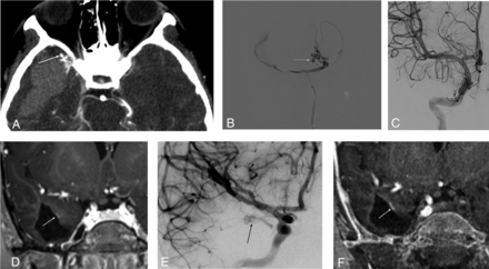 Fig 4.