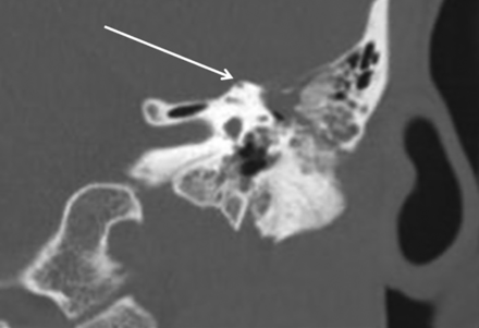 Fig 3.