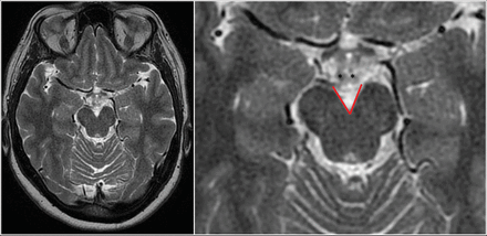 Fig 2.