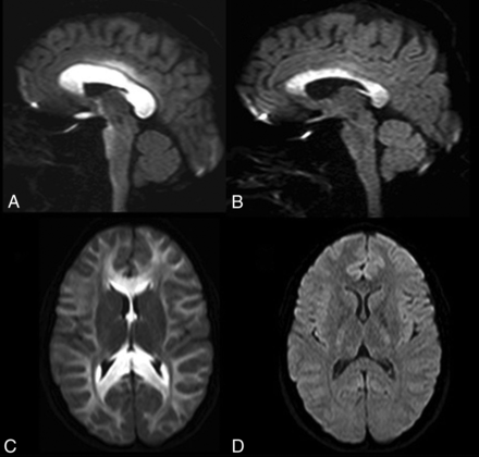 Fig 3.
