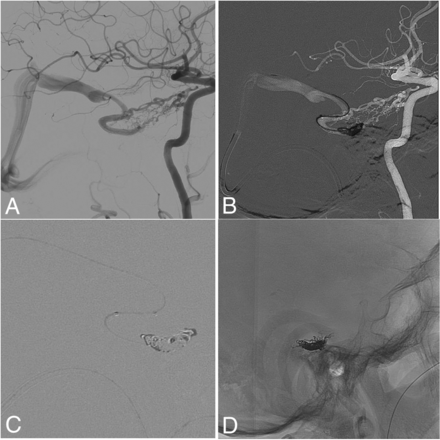 Fig 2.
