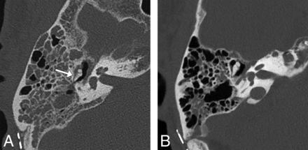 Fig 4.