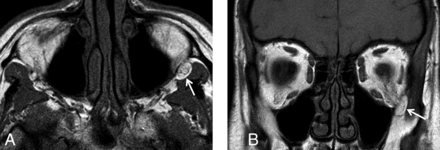 Fig 1.