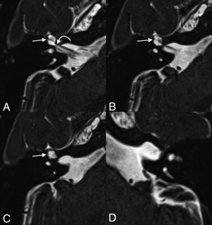 Fig 1.