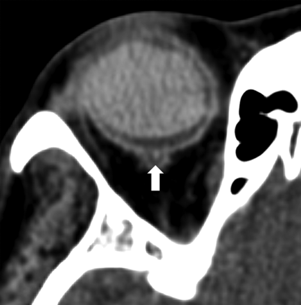 Fig 1.