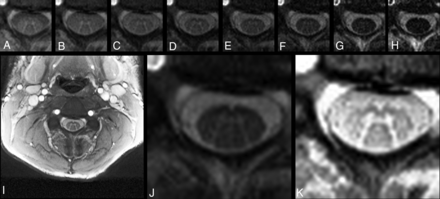 Fig 1.