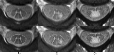 Fig 6.