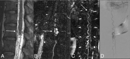 Fig 2.