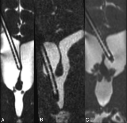 Fig 4.