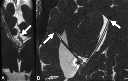 Fig 5.