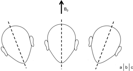 Fig 1.