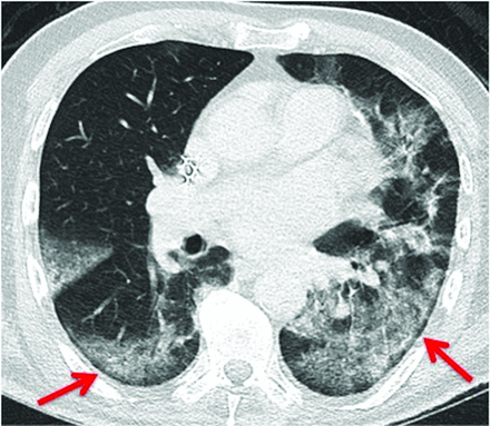 FIG 2.