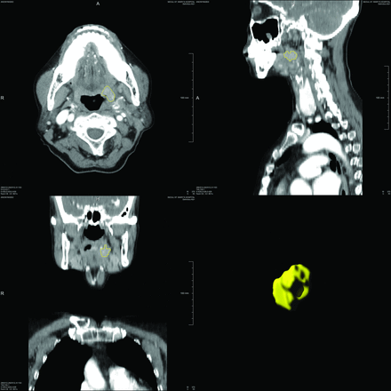 FIG 1.